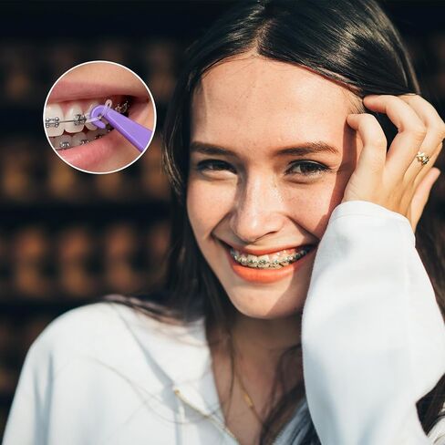 100 Pcs Braces Rubber Band Tool, Colorful Elastic Dental Placer, Disposable Rubber Bands Placer for Women, Men in Kuwait