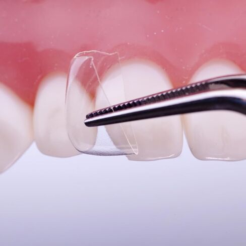 Directa 604038 CoForm Dental Matrix Refills #21 Mesial 8/Pk in Kuwait