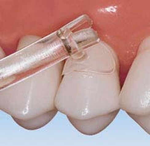 PRM Cure-Thru Cervical Matrice Molar Bx/150 in Kuwait