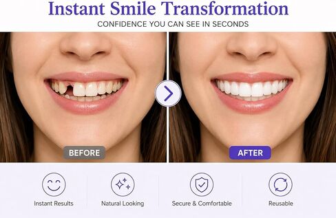 Temporary Veneers for Women & Men – Natural Looking Snap-On Smile Cover, Comfortable Cosmetic Teeth for a Confident Smile, Reusable Upper & Lower Veneers Kit in Kuwait