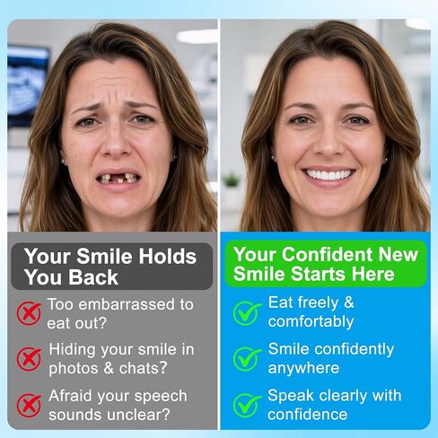 Moldable Silicone Dentures for Women & Men, Natural Cosmetic False Teeth Veneers-GVF8989 in Kuwait