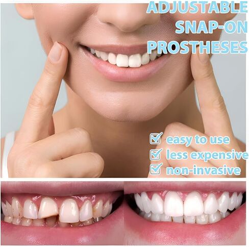 2 Pairs Veneers Teeth for Woman and Man，Comfort Fit Whitening | Smile Beautiful Snapping instants in Kuwait
