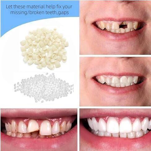 تاج كايملو المؤقت لإصلاح الأسنان والفجوات المكسورة والمفقودة، مجموعة تحسين ابتسامة الأسنان المزيفة، مقاسات وأشكال متعددة in Kuwait