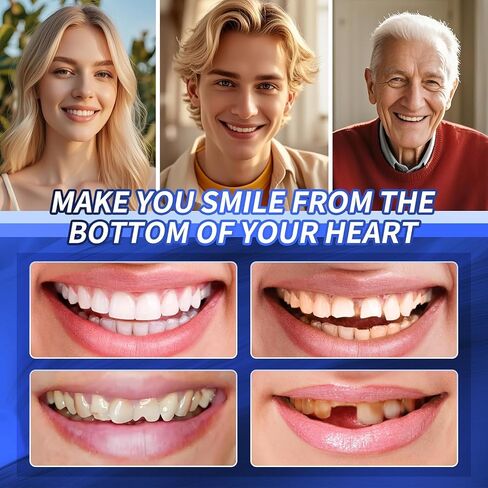 Temporary Veneers Kit for Women and Men, Tooth Replacement Kit, Nature and Comfortable (1 Count (Pack of 1), Unflavored)-AABBA1 in Kuwait