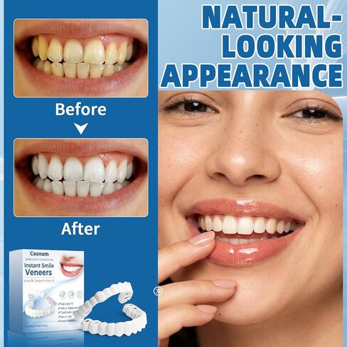 Adjustable Snap-On Veneers Dentures Set – Upper Lower Teeth Covers Tooth Caps, Natural Look False Teeth Kit for Men Women in Kuwait