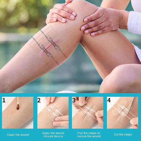 Wound Closure Strips 50x70mm Hydrocolloid Laceration Closure Zip Stitch Adjustable Skin Closures for Home First Aid Kit 2 Pack in Kuwait