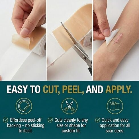 Silicone Scar Tape Roll (60" x 1.6") for Surgical & C-Section Scars | Clinically validated treatment strips and sheets. Highly effective for fading tummy tuck, keloid, and hypertrophic scars in Kuwait