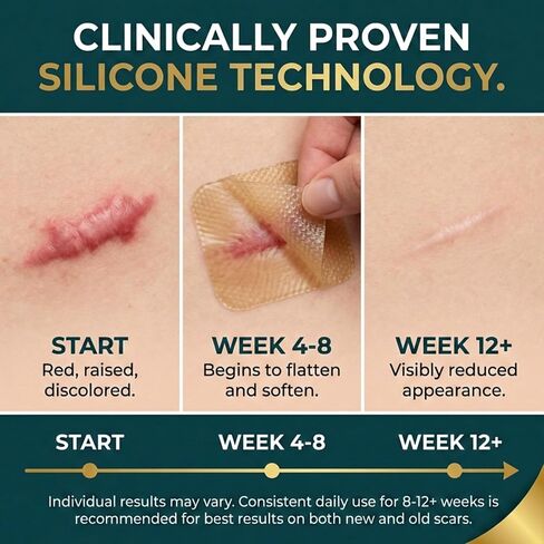Silicone Scar Tape Roll (60" x 1.6") for Surgical & C-Section Scars | Clinically validated treatment strips and sheets. Highly effective for fading tummy tuck, keloid, and hypertrophic scars in Kuwait