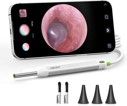 Anykit Digital Otoscope Compatible with Android Devices, Ear Camera with Ear Wax Removal Tools, Video Ear Scope Otoscope with Light, Capture Photos and Videos (Silver) in Kuwait