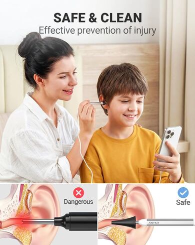 Anykit Digital Otoscope Compatible with Android Devices, Ear Camera with Ear Wax Removal Tools, Video Ear Scope Otoscope with Light, Capture Photos and Videos (Silver) in Kuwait