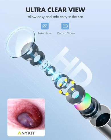 Anykit Digital Otoscope Compatible with Android Devices, Ear Camera with Ear Wax Removal Tools, Video Ear Scope Otoscope with Light, Capture Photos and Videos (Silver) in Kuwait