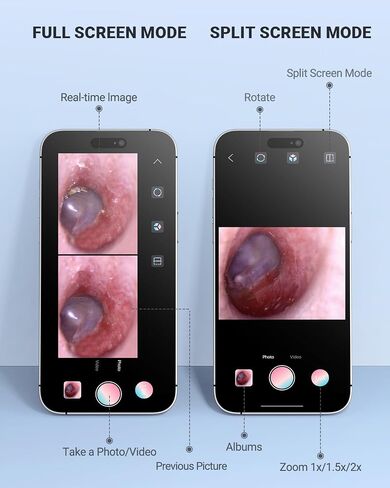 Anykit Digital Otoscope Compatible with Android Devices, Ear Camera with Ear Wax Removal Tools, Video Ear Scope Otoscope with Light, Capture Photos and Videos (Silver) in Kuwait