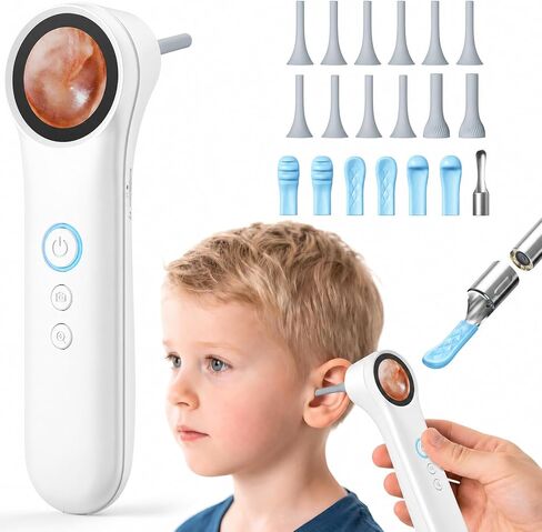 Ear Camera with 1.21" Screen, 1080P HD Digital Otoscope Ear Scope with 4 LED Lights, Ear Cleaner Camera with 10 Ear & Nose Tips, 6 Ear Pick Tools, Skin Probe, Type-C Charging for Adults Kids Pets in Kuwait