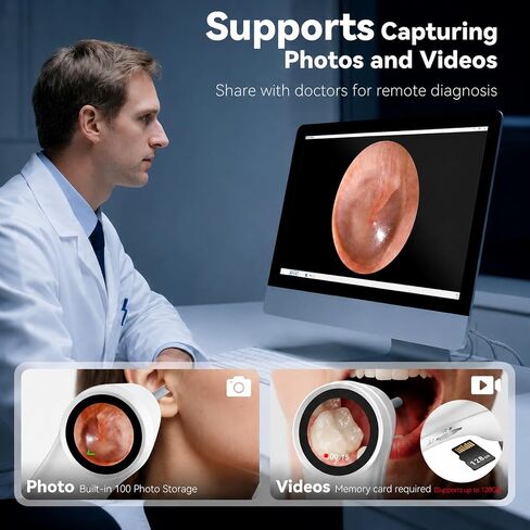 Ear Camera with 1.21" Screen, 1080P HD Digital Otoscope Ear Scope with 4 LED Lights, Ear Cleaner Camera with 10 Ear & Nose Tips, 6 Ear Pick Tools, Skin Probe, Type-C Charging for Adults Kids Pets in Kuwait