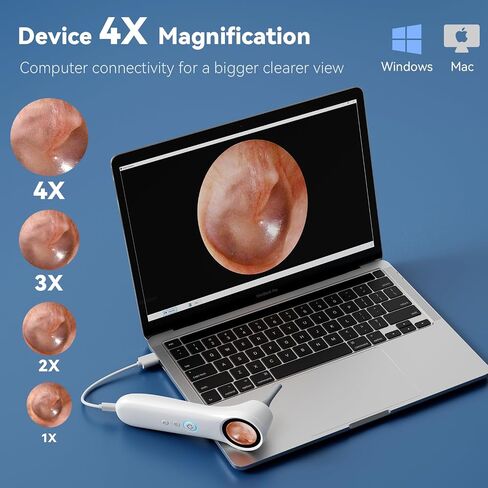 Ear Camera with 1.21" Screen, 1080P HD Digital Otoscope Ear Scope with 4 LED Lights, Ear Cleaner Camera with 10 Ear & Nose Tips, 6 Ear Pick Tools, Skin Probe, Type-C Charging for Adults Kids Pets in Kuwait
