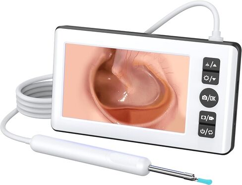Ear Wax Removal Kit with Camera | Ear Cleaner with 4.3" IPS Display, 1080P HD, 2500mAh Battery, Silicone Tips | Standalone Tool, No Phone Required in Kuwait
