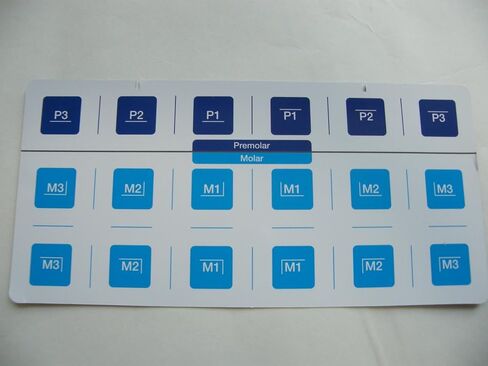 90PCS:Dental Aluminum Temporary Crown (Premolar 6sizes + Molar 12sizes) *5EA in Kuwait