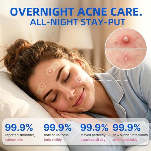 Niceful Hydrocolloid Roll for Acne Medical Grade, 2in*12ft Pimple Patch Roll, Water-Resistant Hydrocolloid Bandages for Wound Care, Highly Absorbent & Cut-to-Size Blister Bandages in Kuwait