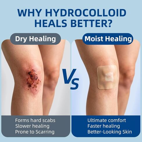 Niceful Hydrocolloid Roll for Acne Medical Grade, 2in*12ft Pimple Patch Roll, Water-Resistant Hydrocolloid Bandages for Wound Care, Highly Absorbent & Cut-to-Size Blister Bandages in Kuwait