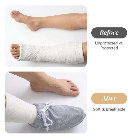 Cast Sock, Adjustable Cast Sock Cover for Foot for Men & Women, Breathable Ribbed Cloth Socks for Casted Foot (Grey, 14.6 x 9.8 Inches) in Kuwait