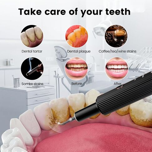 Ultrasonic Tooth Scaler Plaque Remover for Teeth - Tartar Remover for Teeth, Teeth Cleaning Kit, with LED Light & 4 Adjustable Modes. in Kuwait