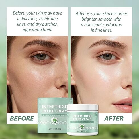 Healora Intertrigo Cream,Skin Fold Barrier Cream for Moisture & Friction Protection, Helps Support Skin Comfort, Fast-Drying Non-Greasy Formula for Friction-Prone Areas. (1) in Saudi Arabia