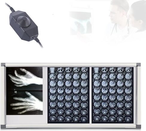 صندوق إضاءة LED بالأشعة السينية، صندوق إضاءة لفيلم عارض الأشعة السينية، مفتاح باهت مع مقبض، يمكن تعليقه، إطار أكريليك وألومنيوم متين، للعيادات والمستشفيات (44.5 × 19 × 0.5 بوصة) in Kuwait