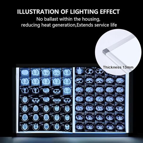 صندوق إضاءة LED بالأشعة السينية، صندوق إضاءة لفيلم عارض الأشعة السينية، مفتاح باهت مع مقبض، يمكن تعليقه، إطار أكريليك وألومنيوم متين، للعيادات والمستشفيات (44.5 × 19 × 0.5 بوصة) in Kuwait