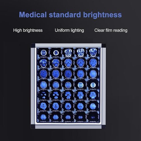صندوق إضاءة LED بالأشعة السينية، صندوق إضاءة لفيلم عارض الأشعة السينية، مفتاح باهت مع مقبض، يمكن تعليقه، إطار أكريليك وألومنيوم متين، للعيادات والمستشفيات (44.5 × 19 × 0.5 بوصة) in Kuwait