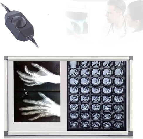 X-Ray Led Lighting Light Box, X-Ray Viewer Film Lighting Light Box, Dimmer Switch with A Knob, Can Stand Can Be Hung, Durable Acrylic & Aluminum Frame, for Clinics & Hospitals (33x19x0.5in) in Kuwait