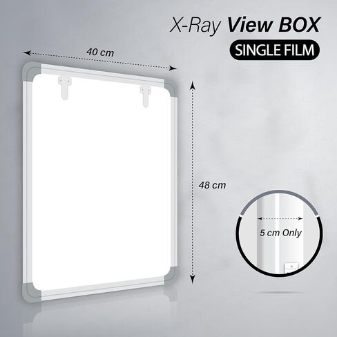 Fully Automatic LED X-Ray View Box with Variable Brightness Control, Extra Bright, for Hospital and Clinic, 1 Year Warranty in Kuwait