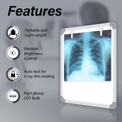 Fully Automatic LED X-Ray View Box with Variable Brightness Control, Extra Bright, for Hospital and Clinic, 1 Year Warranty in Kuwait