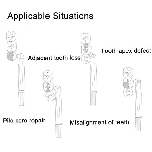 Dental Matrix Bands 180°Adjustable Retainer Metal Restoration Matrix-Profecto Sectional Matrix for Dental Restorations(4 Size 4 Colors) in Kuwait