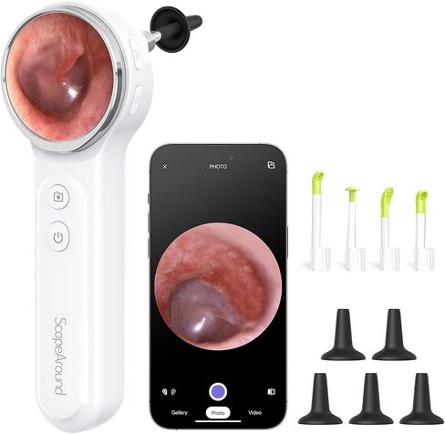ScopeAround Digital Otoscope Camera w/Built-in Screen, Otoscope with Light Ear Scope for Home Use, Ear Light Otoscope with Camera, Easy Viewing for Everyday Ear Checks, Android/iPhone in Kuwait