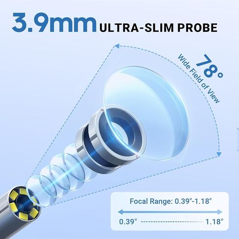 ScopeAround Digital Otoscope Camera w/Built-in Screen, Otoscope with Light Ear Scope for Home Use, Ear Light Otoscope with Camera, Easy Viewing for Everyday Ear Checks, Android/iPhone in Kuwait