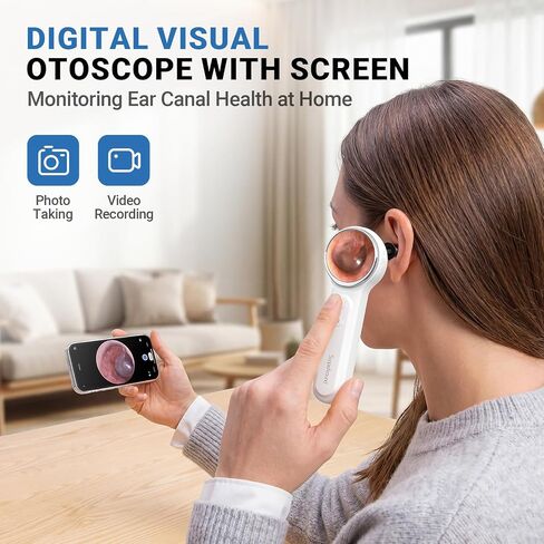 ScopeAround Digital Otoscope Camera w/Built-in Screen, Otoscope with Light Ear Scope for Home Use, Ear Light Otoscope with Camera, Easy Viewing for Everyday Ear Checks, Android/iPhone in Kuwait