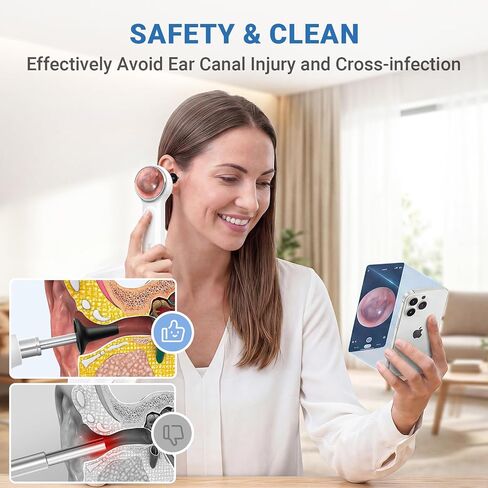 ScopeAround Digital Otoscope Camera w/Built-in Screen, Otoscope with Light Ear Scope for Home Use, Ear Light Otoscope with Camera, Easy Viewing for Everyday Ear Checks, Android/iPhone in Kuwait