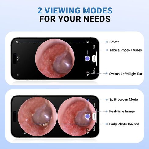 ScopeAround Digital Otoscope Camera w/Built-in Screen, Otoscope with Light Ear Scope for Home Use, Ear Light Otoscope with Camera, Easy Viewing for Everyday Ear Checks, Android/iPhone in Kuwait