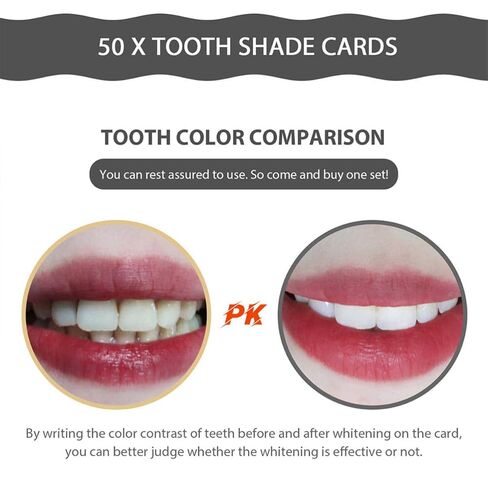 Didiseaon 30pcs Disposable Tooth Color Contrast Cards Paper Shade Guide for Professional and Personal Use Lightweight Oral Care Supplies Random Color in Kuwait