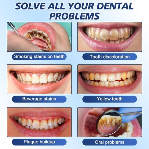 Tooth Paint - Instant Teeth Whitening Paint for Yellow Teeth, Smokers and Coffee Lovers, Creates a Dazzling White Smile in Minutes in Kuwait