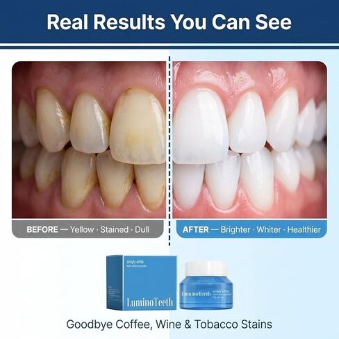 Original LUMINOTEETH Teeth Whitening Powder - Teeth Whitening Powder with Hydroxyapatite - Removes Stains - No Sensitivity - Breath Freshener, Coffee Stain Remover -Strengthens Enamel & Gums in Kuwait