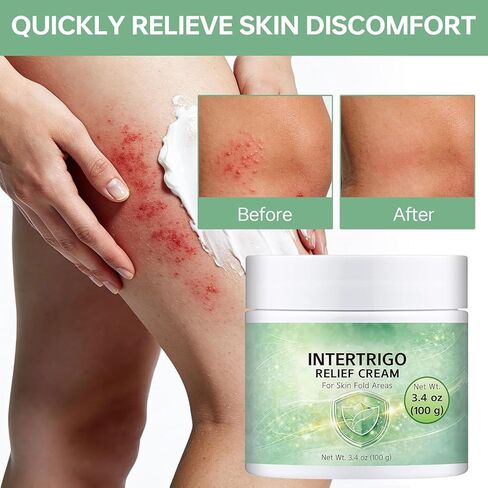 Intertrigo Cream,Skin Fold Barrier Cream for Moisture & Friction Protection, Helps Support Skin Comfort, Fast-Drying Non-Greasy Formula for Friction-Prone Areas. in Kuwait