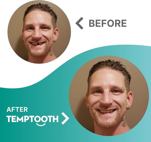 Temptooth Tooth Replacement Product with Coloring Material in Kuwait