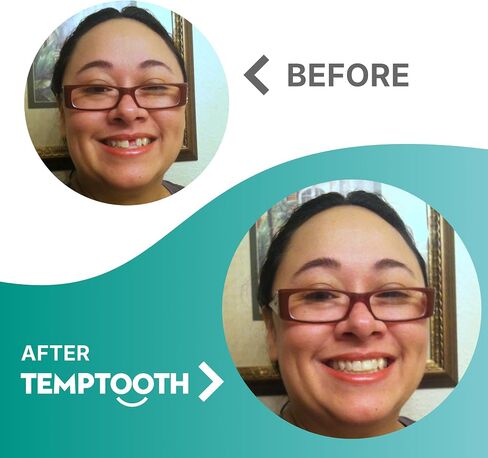 Temptooth Tooth Replacement Product with Coloring Material in Kuwait
