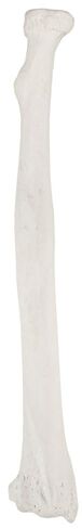 Axis Scientific Radius Bone Model | Right | Cast from a Real Human Radius Bone l Forearm Bone Model Has Realistic Texture and Important Bony Landmarks | Includes Product Manual in Kuwait