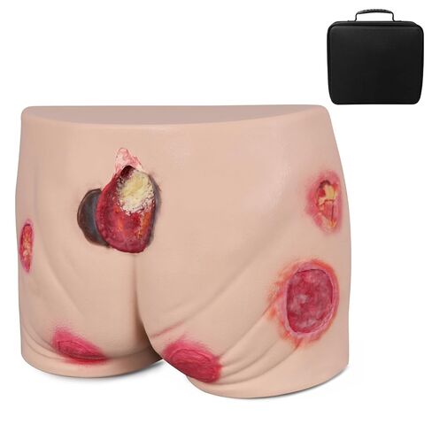 Full Silicone Pressure Ulcer Model, Buttock Decubitus Ulcer Wound Care Training Model, Bedsore Wound Packing Trainer in Kuwait