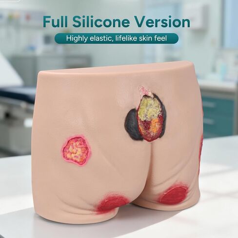 Full Silicone Pressure Ulcer Model, Buttock Decubitus Ulcer Wound Care Training Model, Bedsore Wound Packing Trainer in Kuwait