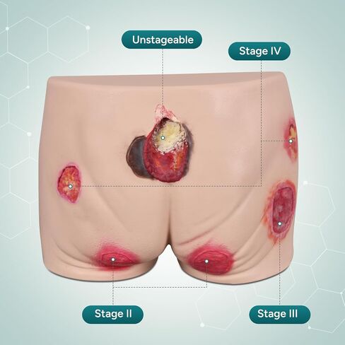 Full Silicone Pressure Ulcer Model, Buttock Decubitus Ulcer Wound Care Training Model, Bedsore Wound Packing Trainer in Kuwait