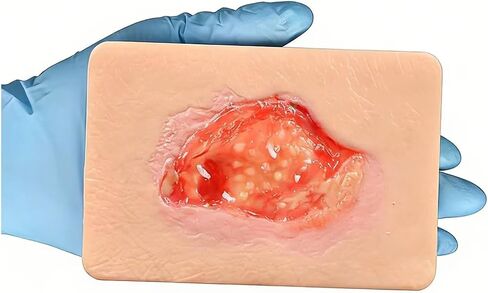 Unhealthy Granulation Wound Simulation Model, Silicone Wound Packing Trainer, Realistic Necrotic Care Training Pad, for Nursing Students Medical Education Teaching in Kuwait