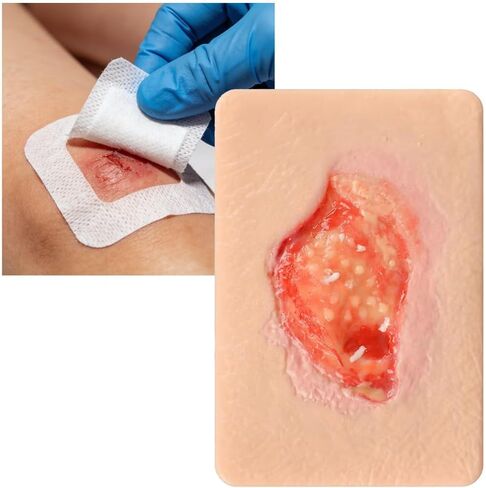 Unhealthy Granulation Wound Simulation Model, Silicone Wound Packing Trainer, Realistic Necrotic Care Training Pad, for Nursing Students Medical Education Teaching in Kuwait